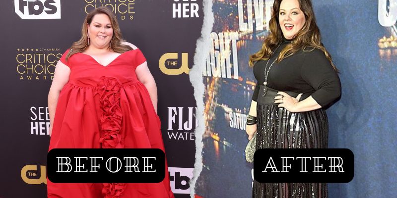 Did Chrissy Metz Have Weight Loss Surgery?